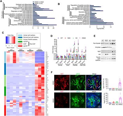 Nuclear GSK-3β and Oncogenic KRas Lead to the Retention of Pancreatic Ductal Progenitor Cells Phenotypically Similar to Those Seen in IPMN